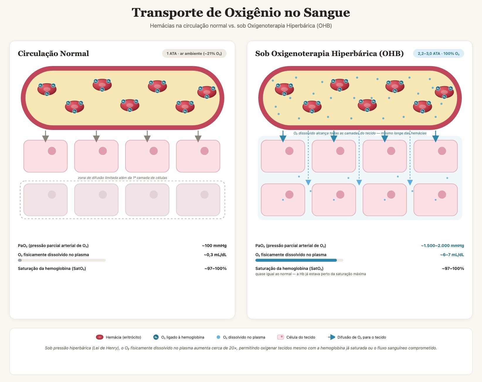 Ilustração da oxigenação do sangue sob pressão hiperbárica: oxigênio dissolvido diretamente no plasma